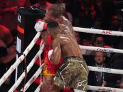 Así quedó la mandíbula de Jake Paul tras el brutal nocaut de Anthony Joshua: doble fractura y 6 semanas de recuperación