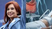 Nuevo parte médico de Cristina Kirchner: evoluciona lentamente y ya puede consumir semisólidos
