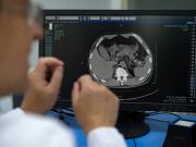 En China, la IA está detectando tumores mortales que los médicos podrían pasar por alto