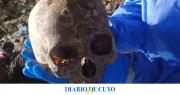Aberrante hallazgo en un basural de Albardón: encontraron un cráneo y buscan determinar si otros restos son humanos