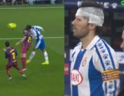 El brutal golpe que se llevó el uruguayo Lele Cabrera ante Barcelona que lo dejó sangrando