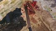 Sangrienta pelea con un machete dejó dos sujetos heridos