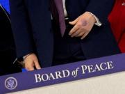 Trump volvió a preocupar por los moretones de sus manos en la Junta de la Paz: dijo que se los hizo por golpear una mesa