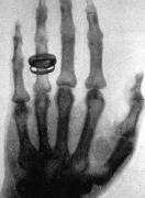 Esposas que apoyan en todo: Incluso si pierden una mano en el proceso -