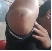 Ciudadano herido tras agresión física