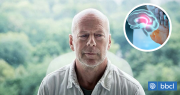 ¿Qué es la anosognosia? Condición que padece Bruce Willis y que fue revelada por su esposa