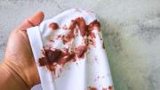 Paso a paso: cómo limpiar las manchas de sangre seca en la ropa