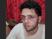 El accidente laboral que se convirtió en un calvario: sus empleadores lo atacaron brutalmente para no pagarle