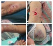 Atacada por canes en Huachi La Libertad