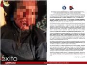 Fiscalía descarta represalia y apunta a robo como móvil de agresión a periodista en El Alto