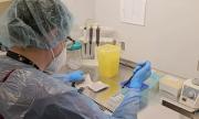 Implementan Test PCR para detección del virus papiloma humano