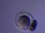 Un nuevo método puede encontrar óvulos ocultos para ayudar en el tratamiento de fertilidad