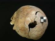 Hallaron en Serbia una fosa de 2.800 años de antigüedad que expone una violenta matanza de niños y mujeres