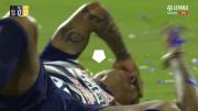 Paolo Guerrero sufrió un duro golpe a la altura del ojo en el Alianza Lima vs. Juan Pablo II