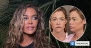 ¿Qué se hizo en el rostro Denise Richards? El sorprendente antes y después de la ex chica Bond