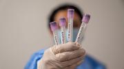 No tiene nada que ver con la covid, el hantavirus tiene escasa capacidad para producir epidemias o una pandemia