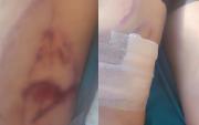 Denuncian que policía resultó herido por dinamitazos de parte de cooperativistas