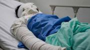 Muere hombre quemado en Shinahota y se eleva a cuatro el número de víctimas por justicia por mano propia