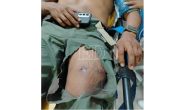 Llegan más policías heridos en el operativo de desbloqueo de San Julián al hospital Obrero