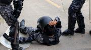 Estado de policías heridos evoluciona de forma favorable, informa la gobernación cruceña