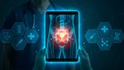 Cómo la tecnología está transformando el diagnóstico y tratamiento del cáncer de próstata