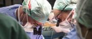 Hong Kong logra el primer trasplante hepático de donante vivo con microcirugía robótica
