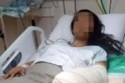 Adolescente sufre quemaduras y se abre investigación por intento de feminicidio