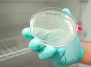 EEUU registra casi 2.000 casos de Cyclospora, un parásito que causa diarrea explosiva