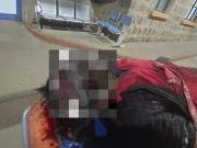 Hombre resulta apuñalado en la zona San Roque y vuelve a evidenciarse la inseguridad en la ciudad