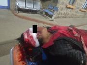 Paciente apuñalado huyó del hospital Bracamonte