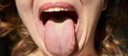 ALGO EN LA SALIVA GUARDA PISTAS SOBRE EL CÁNCER COLORRECTAL