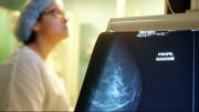 Francia: reconocen por primera vez el origen profesional del cáncer de mama de una azafata