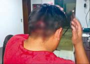 Guardia golpeado: “Me decía que las joyas valían más que mi vida”