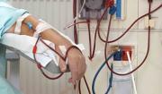 Sedes prepara campaña de cirugías de fístulas para pacientes en diálisis