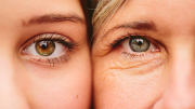 Luteína o ‘vitamina del ojo’: conoce el pigmento que protege tu visión de los rayos ultravioletas