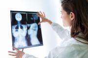 Los cuatro signos de cáncer de mama que no involucran la presencia de un bulto