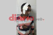 Lo invitó a ver quién era más macho y lo desmayó de ladrillazo en la cabeza