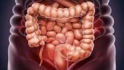 Cáncer de colon: consumir estas frutas ayudan a prevenir la enfermedad