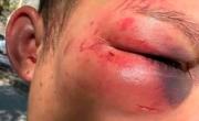 Violencia sin control: brutal ataque a un joven a la salida de un boliche