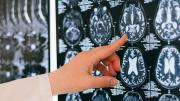 Neurocirujanos suspenden la atención para afiliados de Ioscor: críticas al Gobierno