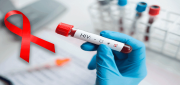 Aprueban un nuevo tratamiento preventivo contra el VIH