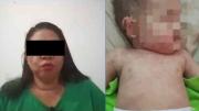 Investigarán a mujer que expuso a su bebé para que contrajera una bacteria en Zulia