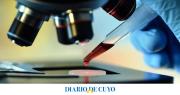 Un nuevo análisis de sangre podría detectar el riesgo de leucemia y evitar métodos invasivos de diagnóstico