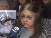 Con los ojos morados y los dedos vendados, habló la esposa del hombre que mató a su suegra a bastonazos: Socorro, vecinos