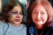 Fue atacada por su esposo y se salvó gracias a que su mamá dio la vida por defenderla