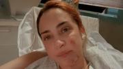 María Julia Oliván mostró cómo está a 19 días de entrar en terapia por quemarse: “No me puedo parar”