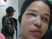 Detenido un funcionario de la PNB acusado de golpear a una mujer. El agente la golpeó en la cara con un casco