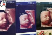 Denuncian que una clínica de Formosa usaba la foto de la misma ecografía para todas las embarazadas