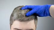 Qué quiere decir si me aparecen canas siendo joven y cuál es el significado