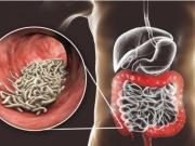 ¿Sabes como desparacitarte? Médico biomagnetista enseñará a la población tarijeña como hacerlo con una charla gratuita